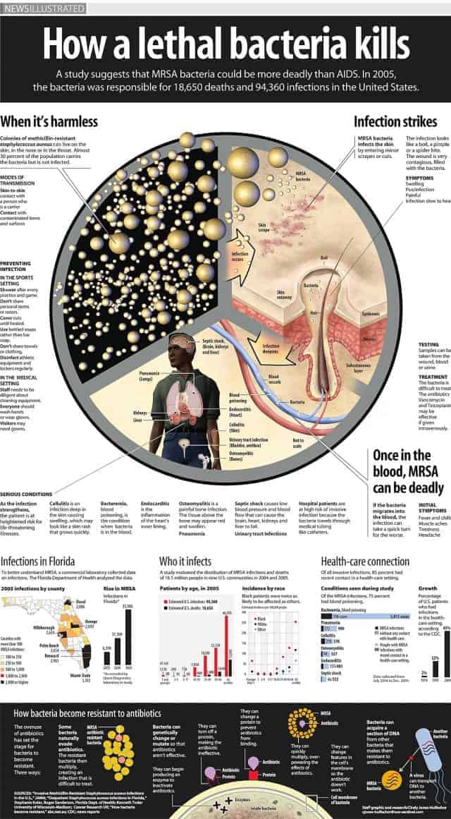 How a Lethal Bacteria Kills Infographic