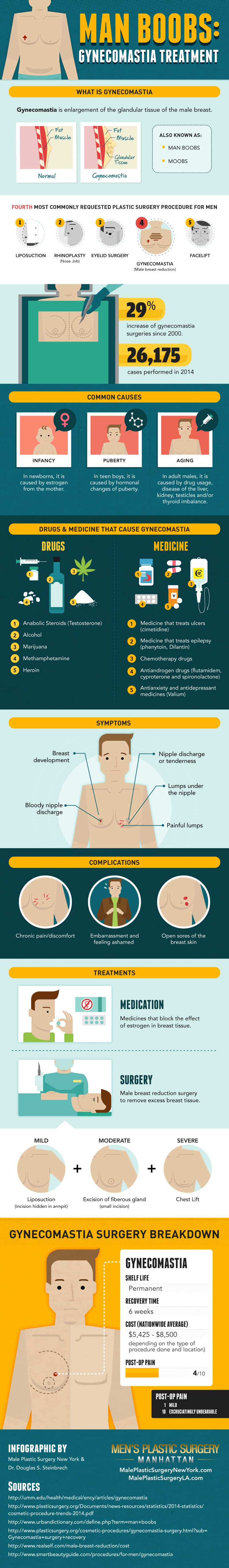 Man Boobs Gynecomastia Treatment Infographic