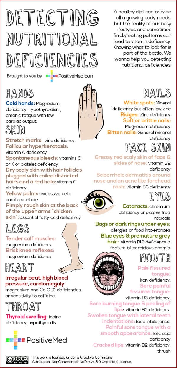 Nutritional deficiencies